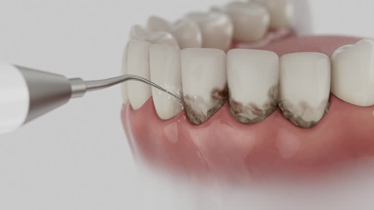 Reliable Dental Implants contractor in Mena, AR by Smile Center Dentistry